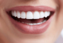 How To Maintain Your Dental Veneers Women Smiling